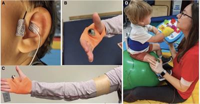Pairing taVNS and CIMT is feasible and may improve upper extremity function in infants
